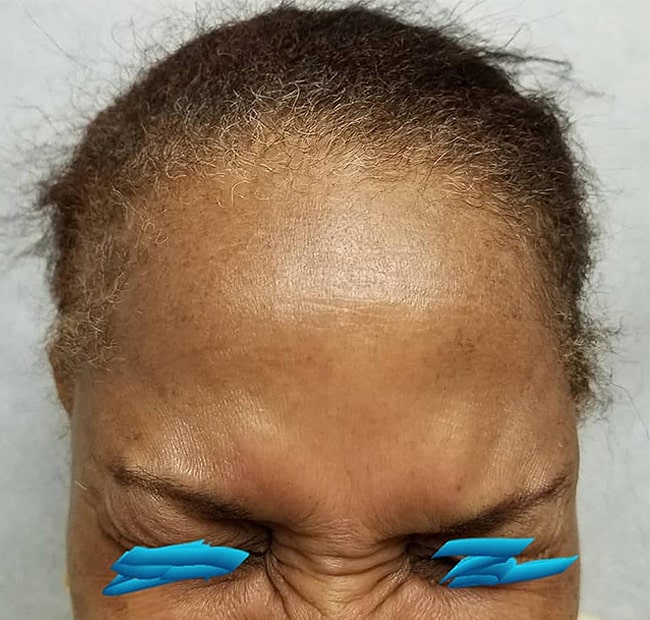 After Image: Neurotoxin - front