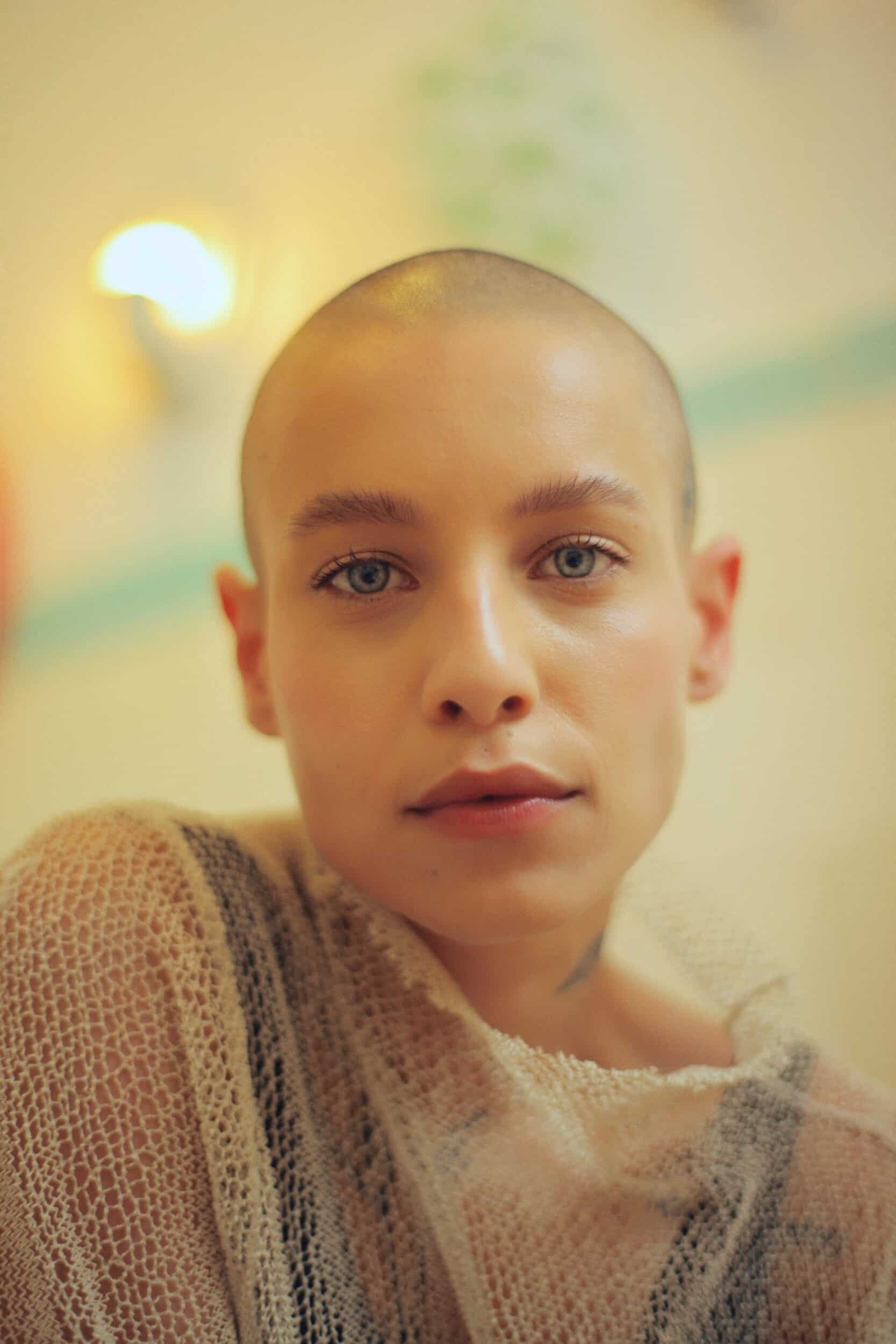 What types of cancer cause hair loss? Aglow Dermatology
