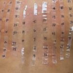 allergy test