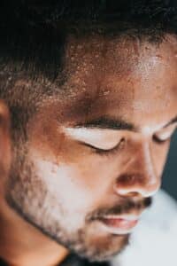 hyperhidrosis treatment as depicted by a man's sweating face