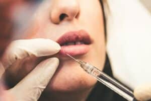 woman getting lip filler