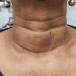 neck lines before
