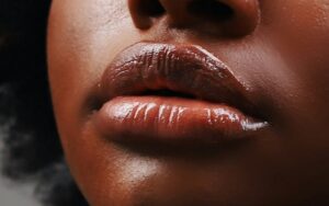 laser for dark lips as depicted by a woman's lips
