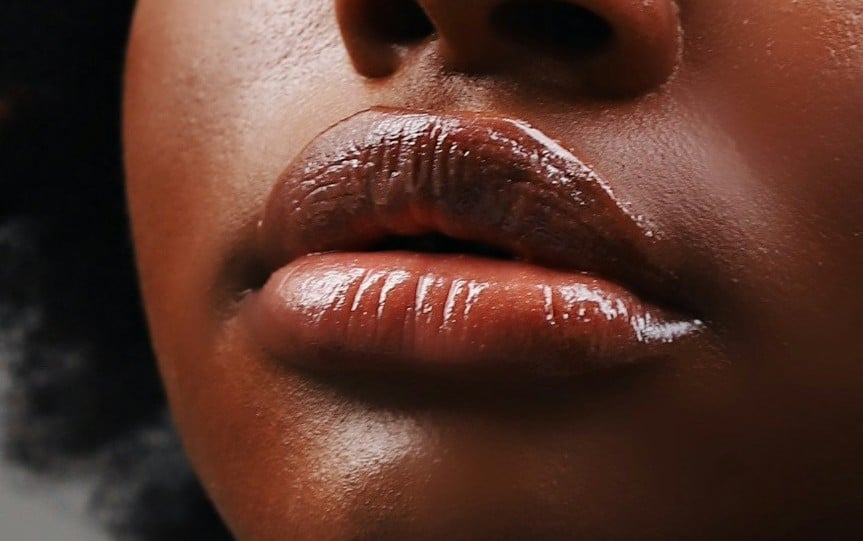 Laser for dark lips - Aglow Dermatology