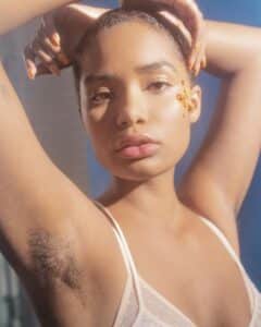 hidradenitis suppurativa treatments as depicted by woman exposing her armpits