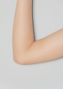 products for keratosis pilaris as depicted by a smooth arm