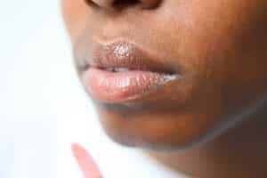 dry lip treatment as depicted by lips