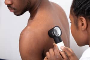 Close up Of A Female Doctor Checking Pigment Skin On Mans Back With Dermatoscope Close up Of A Female Doctor Checking Pigment Skin On Mans Back With Dermatoscope
