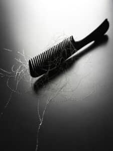 exosomes for hair loss as depicted by a comb with hair in it