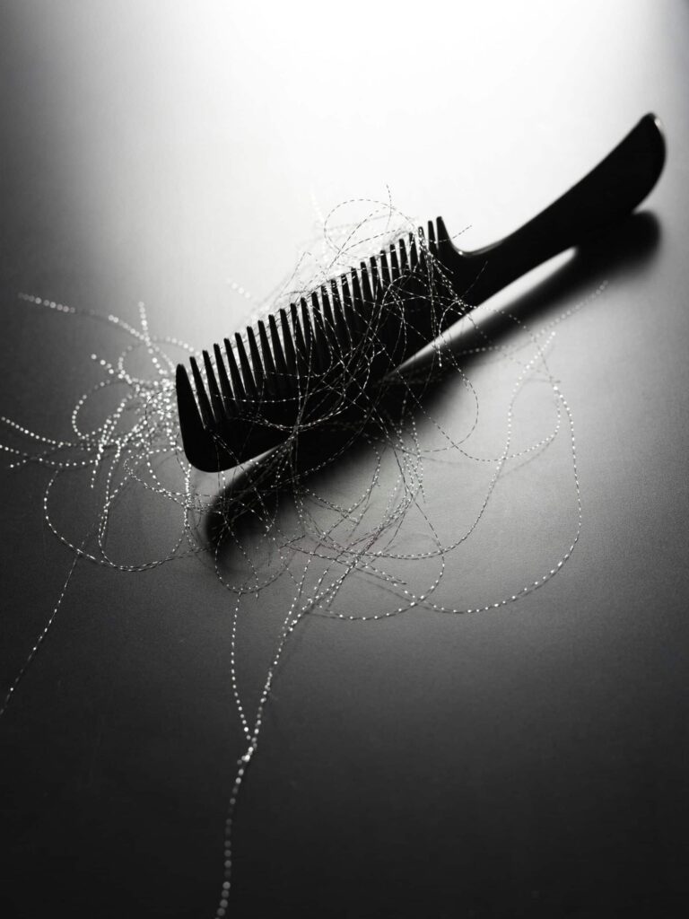 exosomes for hair loss as depicted by a comb with hair in it