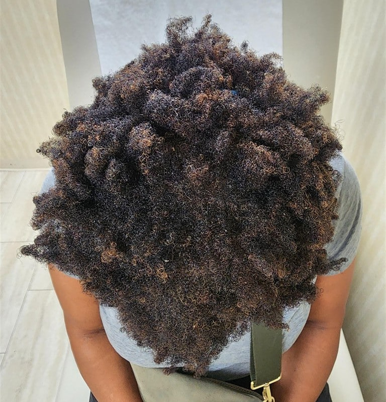 After Image: Alma Ted Hair Treatment Before and After - front