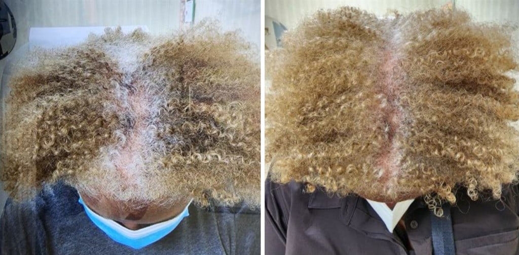 growing hair with dihexa Noticing your is not growing? Your hair keeps being on a certain length for months if not years, you have a lot of product build up and lots of hair breakage Dermatologist Recommended Hair Growth Caps